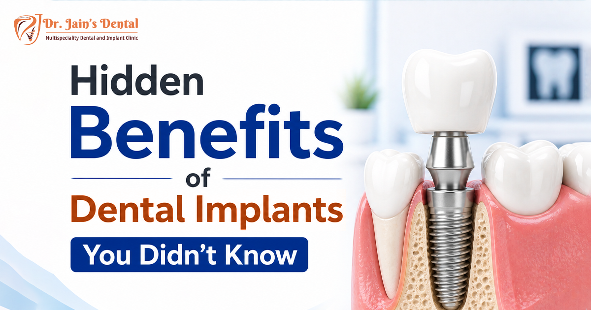 Hidden Benefits of Dental Implants You Didn’t Know